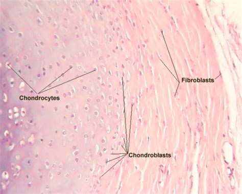 Cartilage ( cells & types of cartilage) Flashcards | Quizlet