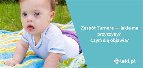 Zesp Turnera Przyczyny Objawy I Sposoby Leczenia