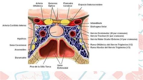 ANATOMIA HUMANA Del Hueso Esfenoides Pptx