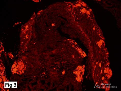 Congo Red Stain | Teaching Points | Arkana Laboratories