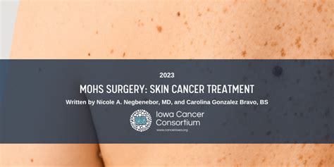 Mohs Surgery Skin Cancer Treatment Iowa Cancer Consortium