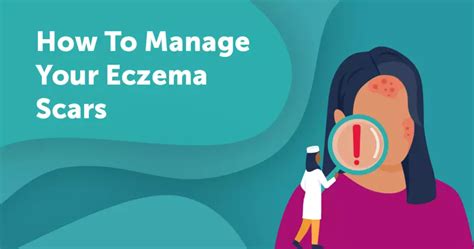 How To Manage Your Eczema Scars | MyEczemaTeam