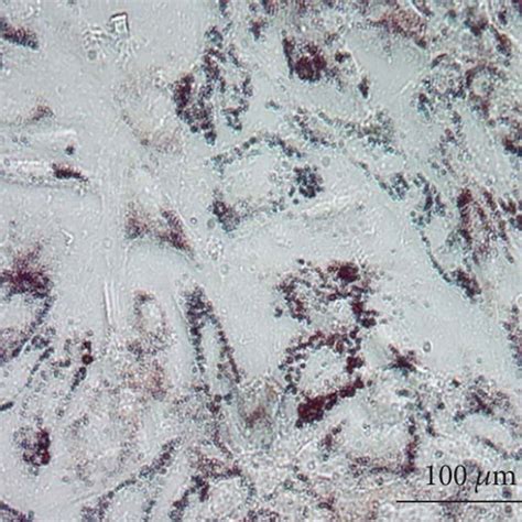 Characteristics Of Isolated Human Amniotic Fluid Derived Mesenchymal