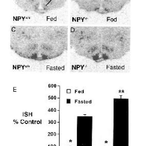 The Number Of Cells Expressing Leptin Induced Pstat3 In The Dorsomedial Download Scientific