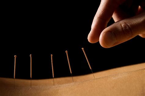 Lotus Acupuncture Wiltshire Devizes Central Wiltshire Location England