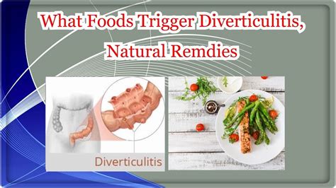 What Foods Trigger Diverticulitis Natural Remdies Youtube