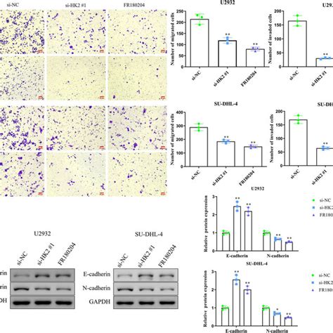 HK2 Knockdown Inhibits U2932 And SU DHL 4 Cell Migration And Invasion