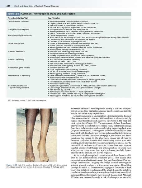 Zitelli And Davis Atlas Of Pediatric Physical Diagnosis Zitelli 7 Ed