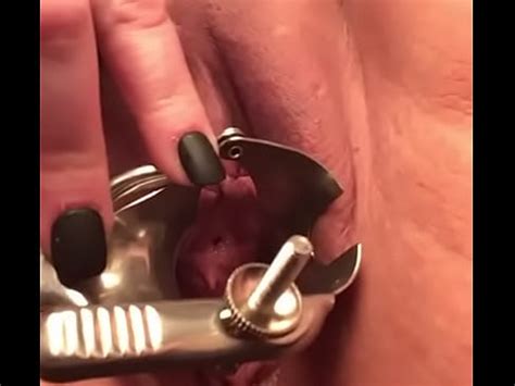 Gaping My Pussy With Speculum XNXX