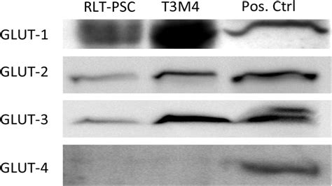 Western Blot Analysis Of Glut 14 On Human Rlt Psc And T3m4