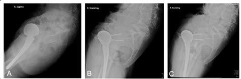 [diagram] X Ray Pelvis Diagram Mydiagram Online