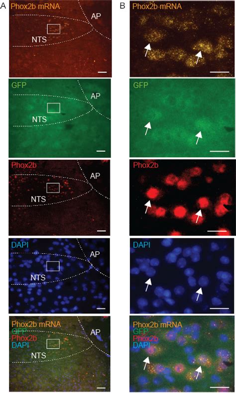 Combining Multiplex Fluorescence In Situ Hybridization With Fluorescent