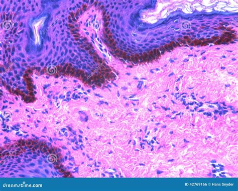 Histology Of Skin Stained With H E Stock Photo Image Of Skin