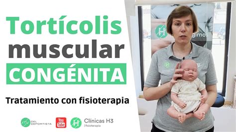 Tratamiento Tort Colis Muscular Cong Nita Cl Nica H Fisioterapia