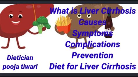 Diet Plan For Liver Cirrhosis Nutrition Therapyलीवर सिरोसिस के लक्षणलीवर सिरोसिस के बारे में