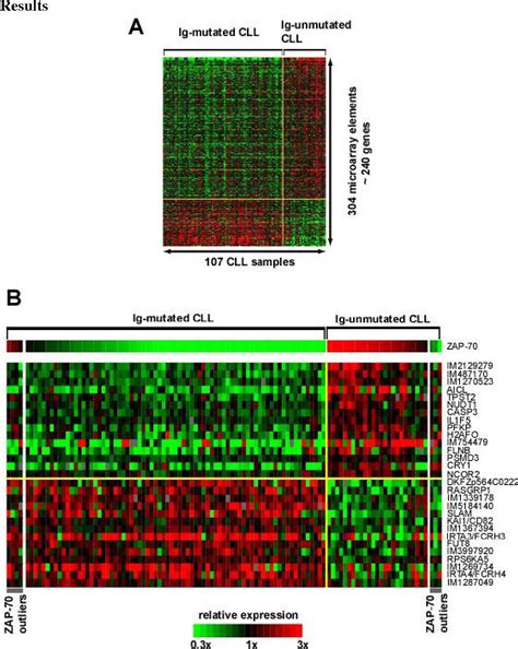 Figure 1 From Gene Expression Profile Unmutated Immunoglobulin Genes Inferior Clinical Outcome