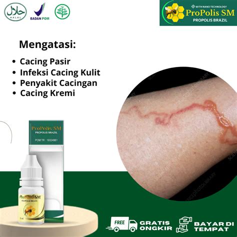 Jual Obat Cacing Pasir Infeksi Cacing Kulit Larva Cacing Tambang