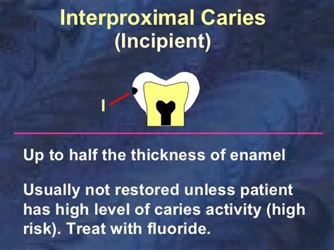 radiographic-caries-diagnosis