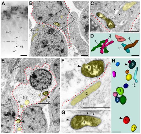 Alteration Of Slp2 Like Immunolabeling In Mitochondria Signifies Early