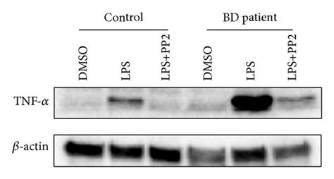 Inhibition Of Lps Induced Tnf α Production By Pp2 In Pbmc Of Active Bd