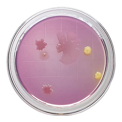 Bd Diagnostic 221288 Trypticase Soy Agar With Lecithin And