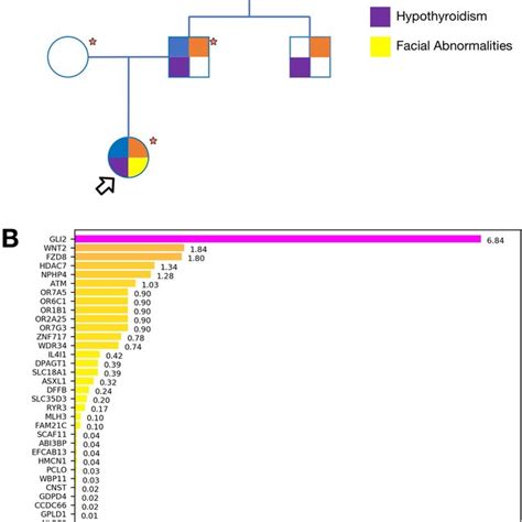 Exome Sequencing Identifies Gli As Candidate Disease Gene A