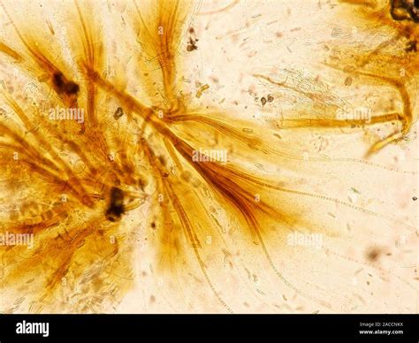 Cyanobacteria Light Micrograph These Are Filaments Brown Of