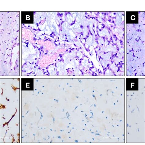 Figure E A C Hematoxylin And Eosin Staining Showing The Cardiac