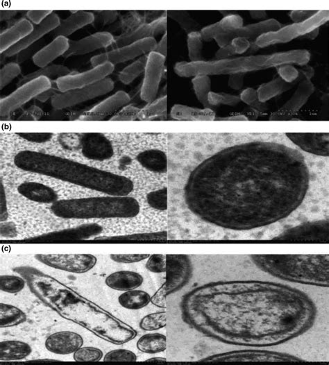 The Morphology Of Li Observed By Sem And Tem Download Scientific Diagram