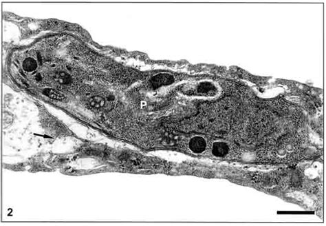 Transmission Electron Micrograph Of Human Umbilical Vein Endothelial