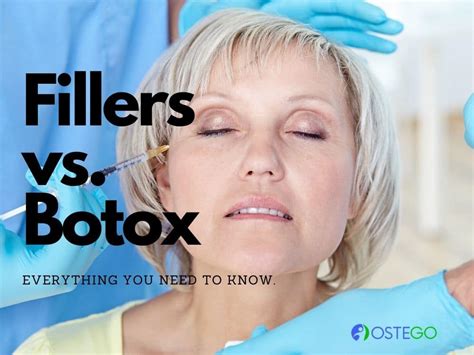 Fillers Vs Botox: How To Choose The Right Cosmetic Treatment Easily