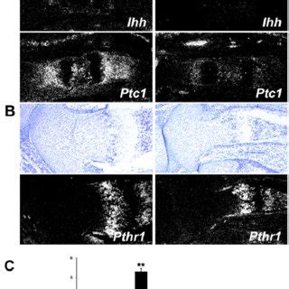 Defects In Hypertrophic Differentiation In Bmpr1a CKO Mice A E14 5