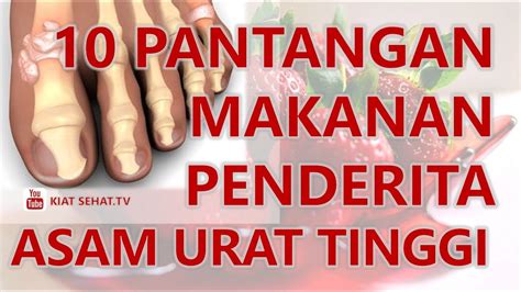 Asam Pantangan Makanan Urat