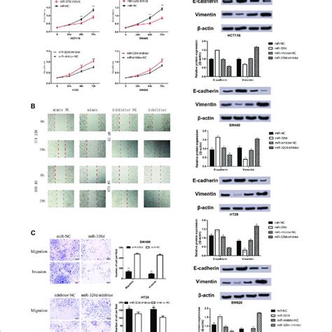 Figure3 Ectopic Expression Of Mir 320d Inhibits The Proliferation Download Scientific