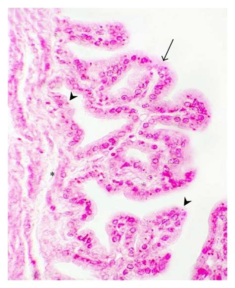 Photomicrographs Showing The Variation In The Amount Of Lipofuscin Download Scientific Diagram