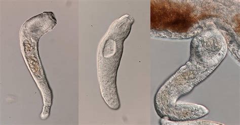 Human Infecting Parasite Produces Sterile Soldiers Like Ants And Termites