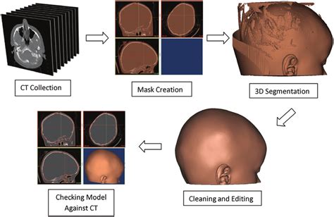 Steps In Ct Segmentation And Reconstruction Download Scientific Diagram