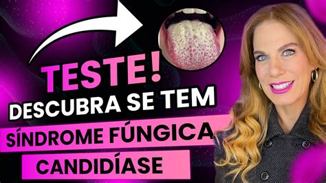 Teste Caseiro De CandidÍase Fungos E SÍndrome Fungica Carina