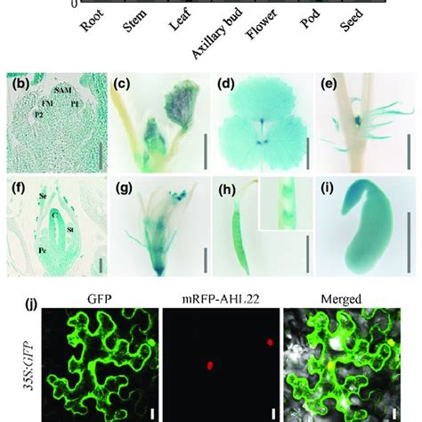 Expression Pattern Of Slb In Medicago Truncatula And Subcellular