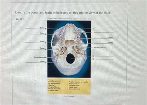 Solved Identify The Bones And Features Indicated On This Chegg