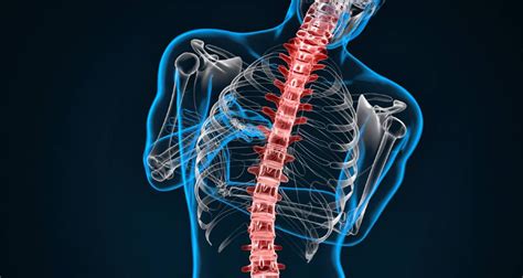 O Que Escoliose Como Ocorre O Diagn Stico E Poss Veis Tratamentos