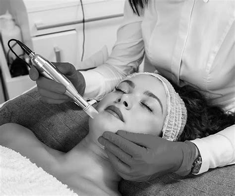 Collagen Induction Therapy With Microneedling Suvita Medical Aesthetics