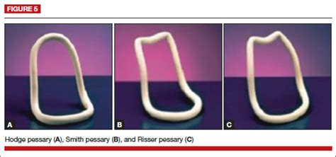 pessaries  vaginal prolapse critical factors  successful fit