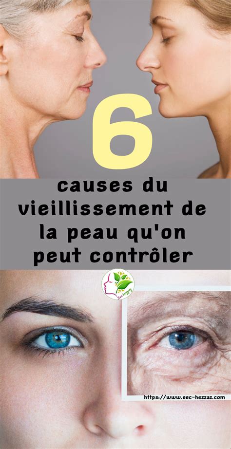 Causes Du Vieillissement De La Peau Qu On Peut Contr Ler