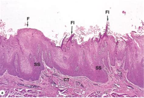 1 Histo Of Mouth And Salivary Glands Flashcards Quizlet