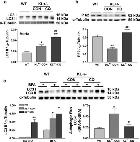 Chloroquine Suppressed Autophagy In Klotho Deficient Mice Kl A