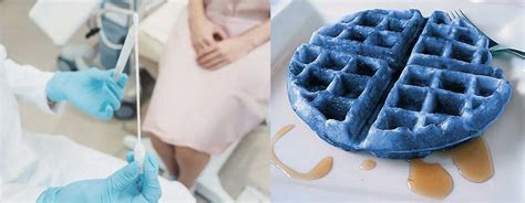 BLUE WAFFLE DISEASE- A DETAILED STUDY - Hasti Transformation