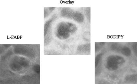 Co Localization Of Bodipy Fl C And L Fabp Cellular Bodipy Fl C