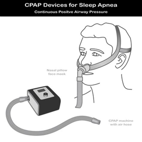 The CPAP Nasal Pillow | The less invasive way to use CPAP therapy