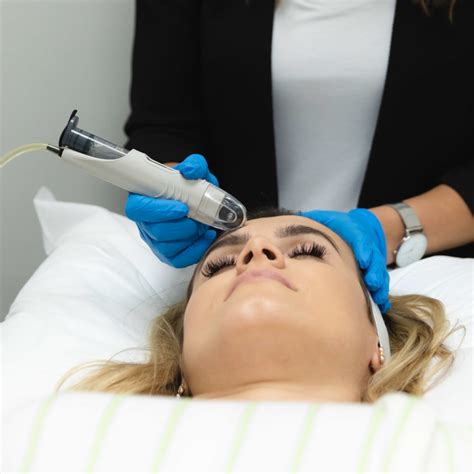 Enhance Your Microneedling Treatments In West Bloomfield With Dermafrac